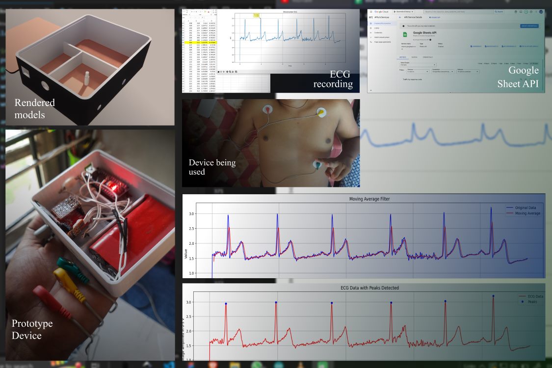 Cloud based ECG monitoring device